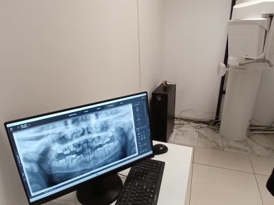 ÖZDENT Ağız ve Diş Sağlığı Polikliniği